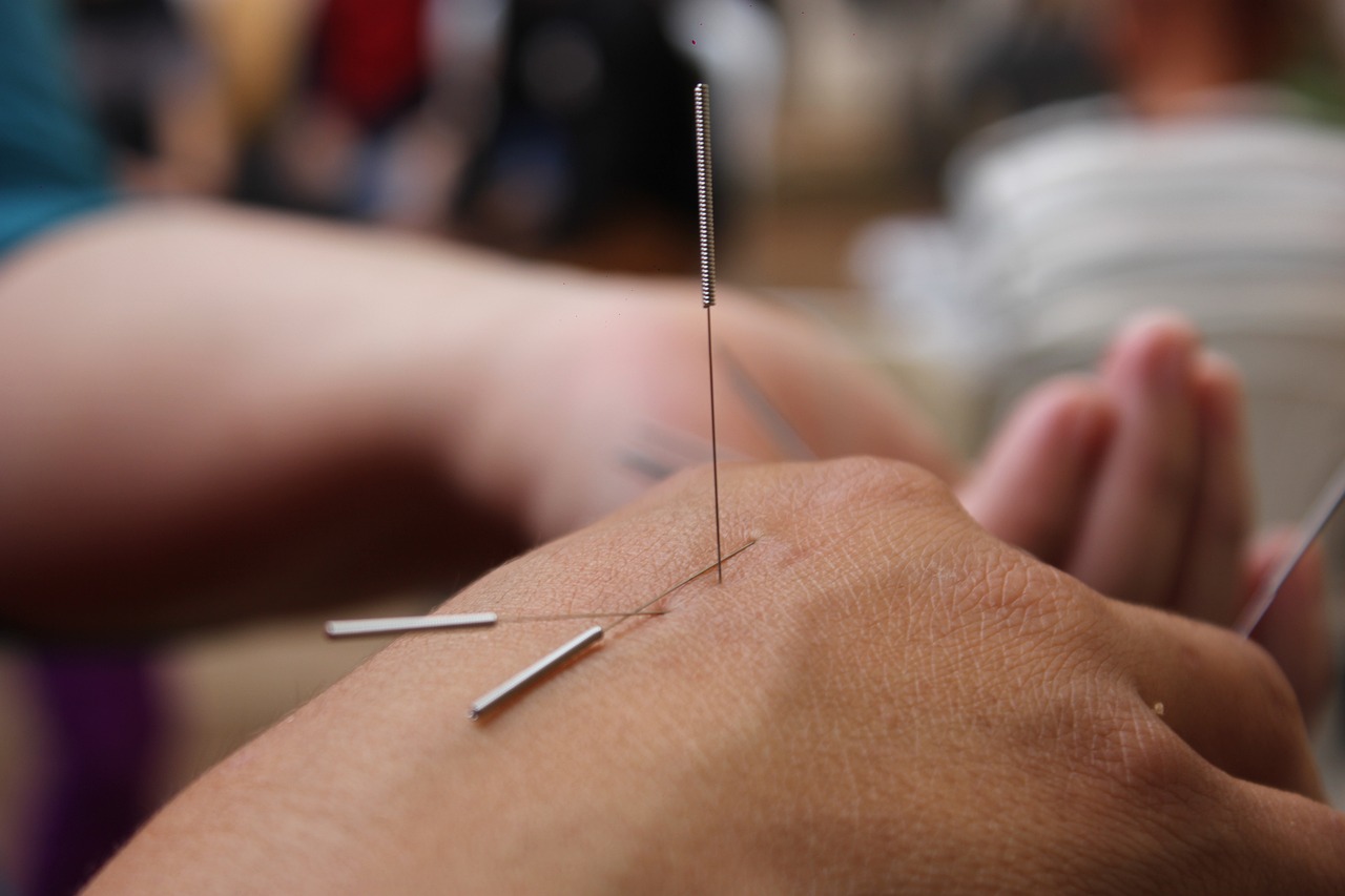 The Philosophy of Acupuncture – Substantiating the Science